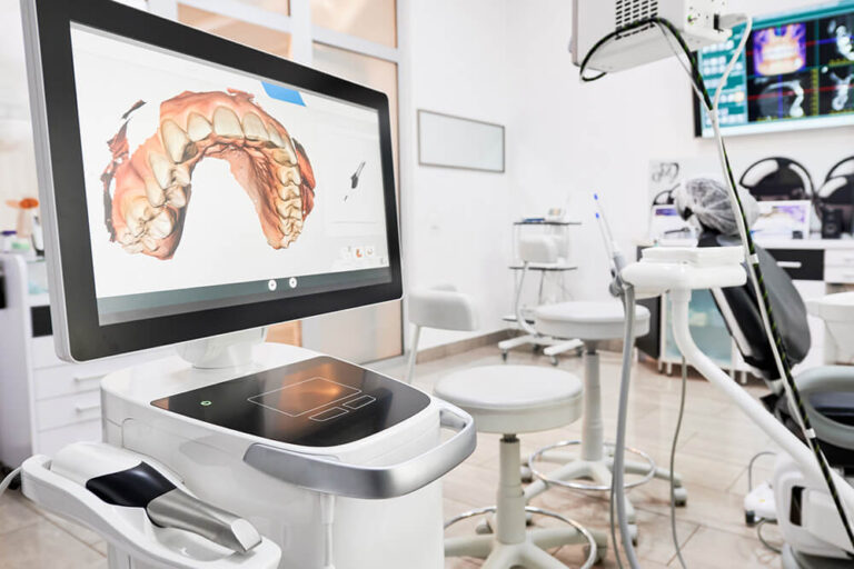 Chairside Economical Restorations of Esthetic Ceramic (CEREC) machine that is used at The Dental Family