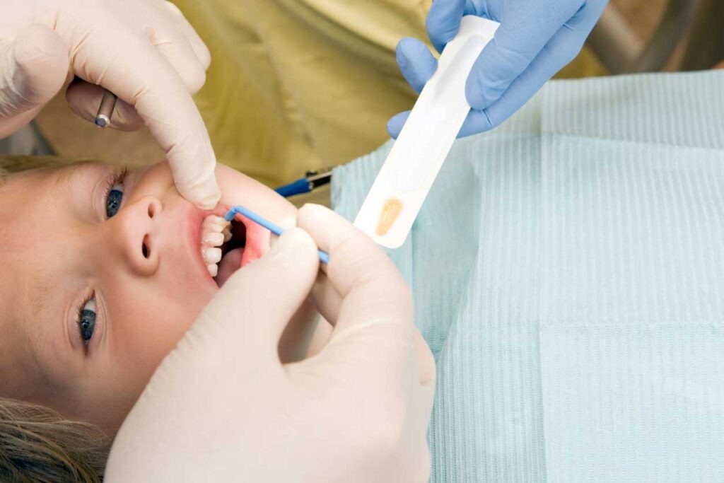 Fluoride treatment on a kid at a dental clinic