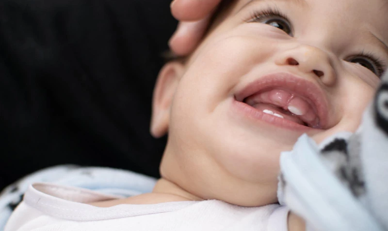 Lip tie or tongue tie pediatric dental treatment at The Dental Family in Westfield and Cranford, NJ.